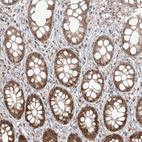 Immunohistochemical staining of human rectum shows strong positivity in nucleoli in glandular cells.