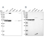 Western blot analysis using Anti-BYSL antibody HPA031219 (A) shows similar pattern to independent antibody HPA031217 (B).