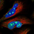 Immunofluorescent staining of human cell line U-2 OS shows localization to nucleus, nucleoli & vesicles.