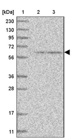 Lane 1: Marker [kDa] 230, 130, 95, 72, 56, 36, 28, 17, 11_br/_Lane 2: Human cell line RT-4_br/_Lane 3: Human cell line U-251MG sp