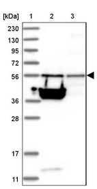 Lane 1: Marker [kDa] 230, 130, 95, 72, 56, 36, 28, 17, 11_br/_Lane 2: Human cell line RT-4_br/_Lane 3: Human cell line U-251MG sp