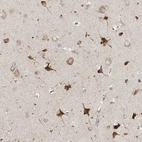 Anti-TSSC1 Antibody