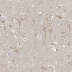 Anti-TSSC1 Antibody