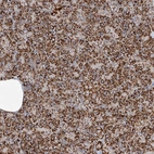 Anti-TTC27 Antibody