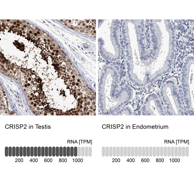 Anti-CRISP2 Antibody