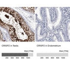 Anti-CRISP2 Antibody