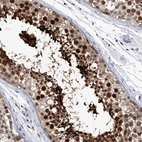 Immunohistochemical staining of human testis shows high expression.