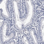 Immunohistochemical staining of human endometrium shows low expression as expected.