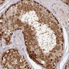 Anti-YAE1D1 Antibody
