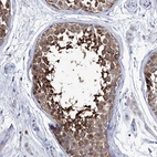 Anti-KLHL17 Antibody