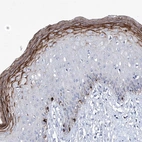 Immunohistochemical staining of human skin shows strong cytoplasmic positivity in melanocytes.