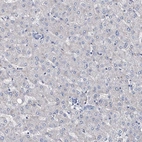 Immunohistochemical staining of human liver shows no positivity in hepatocytes as expected.