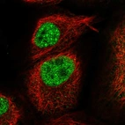 Immunofluorescent staining of human cell line A-431 shows localization to nucleoplasm & nuclear bodies.