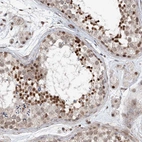 Immunohistochemical staining of human Testis shows strong nuclear positivity in cells in seminiferous ducts.