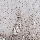Immunohistochemical staining of human Cervix shows moderate nuclear positivity in squamous epithelial cells.