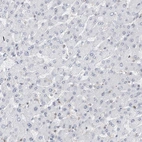 Immunohistochemical staining of human Liver shows very weak nuclear positivity in hepatocytes.