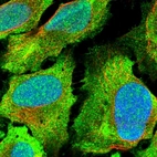 Immunofluorescent staining of human cell line U-2 OS shows positivity in nucleus, plasma membrane & cytoplasm.