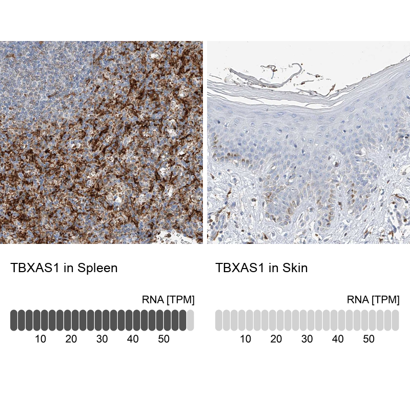 Anti-TBXAS1 Antibody