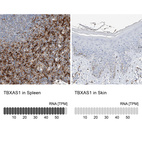 Anti-TBXAS1 Antibody