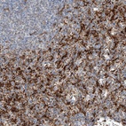 Anti-TBXAS1 Antibody