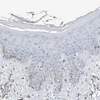Immunohistochemical staining of human skin shows low expression as expected.