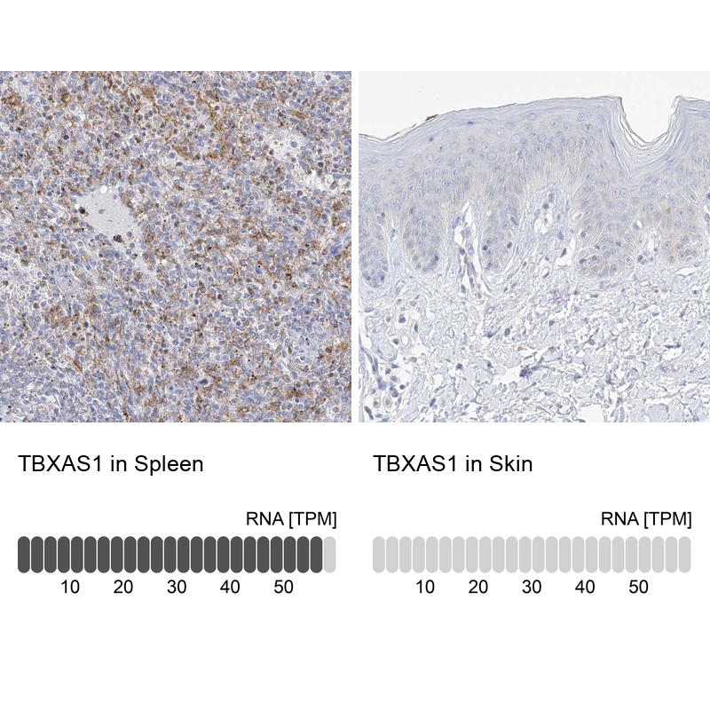 Anti-TBXAS1 Antibody
