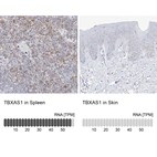 Anti-TBXAS1 Antibody