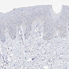 Immunohistochemical staining of human skin shows low expression as expected.