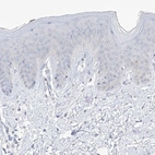 Immunohistochemical staining of human skin shows low expression as expected.