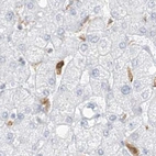 Immunohistochemical staining of human liver using Anti-TBXAS1 antibody HPA031258.