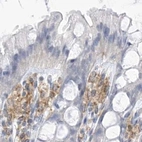 Immunohistochemical staining of human colon using Anti-TBXAS1 antibody HPA031258.