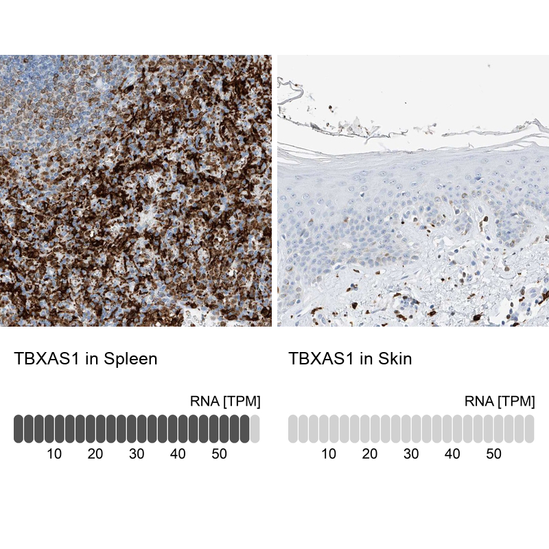 Anti-TBXAS1 Antibody