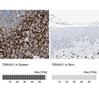 Anti-TBXAS1 Antibody