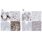 Immunohistochemical staining of human colon, liver, skin and spleen using Anti-TBXAS1 antibody HPA031259 (A) shows similar protein distribution across tissues to independent antibody HPA031258 (B).