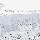 Immunohistochemical staining of human skin shows low expression as expected.