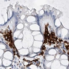 Immunohistochemical staining of human colon using Anti-TBXAS1 antibody HPA031259.