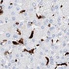 Immunohistochemical staining of human liver using Anti-TBXAS1 antibody HPA031259.