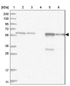 Lane 1: Marker [kDa] 230, 130, 95, 72, 56, 36, 28, 17, 11_br/_Lane 2: Human cell line RT-4_br/_Lane 3: Human cell line U-251MG sp_br/_Lane 4: Human plasma (IgG/HSA depleted)_br/_Lane 5: Human liver tissue_br/_Lane 6: Human tonsil tissue