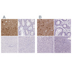 Immunohistochemical staining of human cerebral cortex, colon, liver and pancreas using Anti-NECAB1 antibody HPA031262 (A) shows similar protein distribution across tissues to independent antibody HPA023629 (B).
