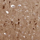 Immunohistochemical staining of human cerebral cortex shows strong cytoplasmic positivity in neurons.