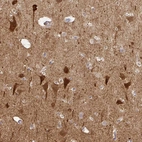 Immunohistochemical staining of human cerebral cortex shows strong cytoplasmic positivity in neurons.