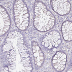 Immunohistochemical staining of human colon shows no positivity in glandular cells as expected.