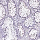 Immunohistochemical staining of human colon shows no positivity in glandular cells as expected.