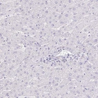 Immunohistochemical staining of human liver shows no positivity in hepatocytes as expected.