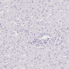Immunohistochemical staining of human liver shows no positivity in hepatocytes as expected.