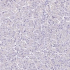 Immunohistochemical staining of human pancreas shows no positivity in exocrine glandular cells as expected.