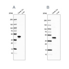 Western blot analysis using Anti-NECAB1 antibody HPA031262 (A) shows similar pattern to independent antibody HPA023629 (B).