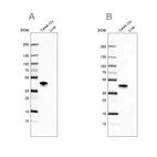 Western blot analysis using Anti-NECAB1 antibody HPA031262 (A) shows similar pattern to independent antibody HPA023629 (B).
