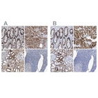 Anti-COQ3 Antibody