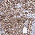 Immunohistochemical staining of human heart muscle shows strong cytoplasmic granular positivity in cardiomyocytes.